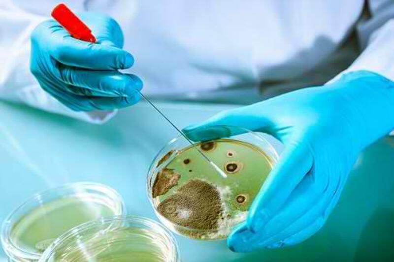Bacterial Risk in Cracked Mugs Microscopic bacteria illustrating hygiene risks associated with cracked mugs